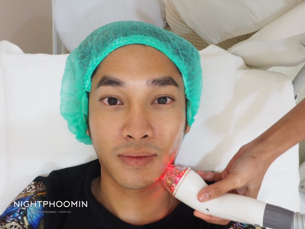 Ulthera, Thermage, minerva clinic, Men's grooming, health, ผิวสวย, สุขภาพดี, บิวตี้บล็อกเกอร์, beauty blogger, รีวิว, review, pantip, พันทิป, เลเซอร์, laser
