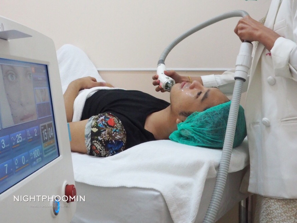 Ulthera, Thermage, minerva clinic, Men's grooming, health, ผิวสวย, สุขภาพดี, บิวตี้บล็อกเกอร์, beauty blogger, รีวิว, review, pantip, พันทิป, เลเซอร์, laser