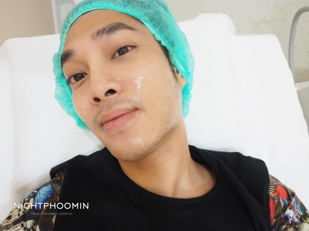 Ulthera, Thermage, minerva clinic, Men's grooming, health, ผิวสวย, สุขภาพดี, บิวตี้บล็อกเกอร์, beauty blogger, รีวิว, review, pantip, พันทิป, เลเซอร์, laser