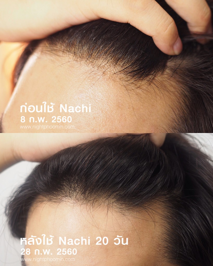 Nachi-anti-loss-hair-11