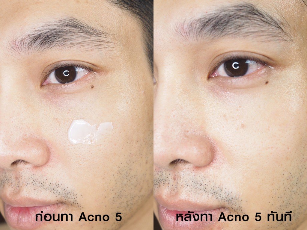 acno5-7-nightphoomin